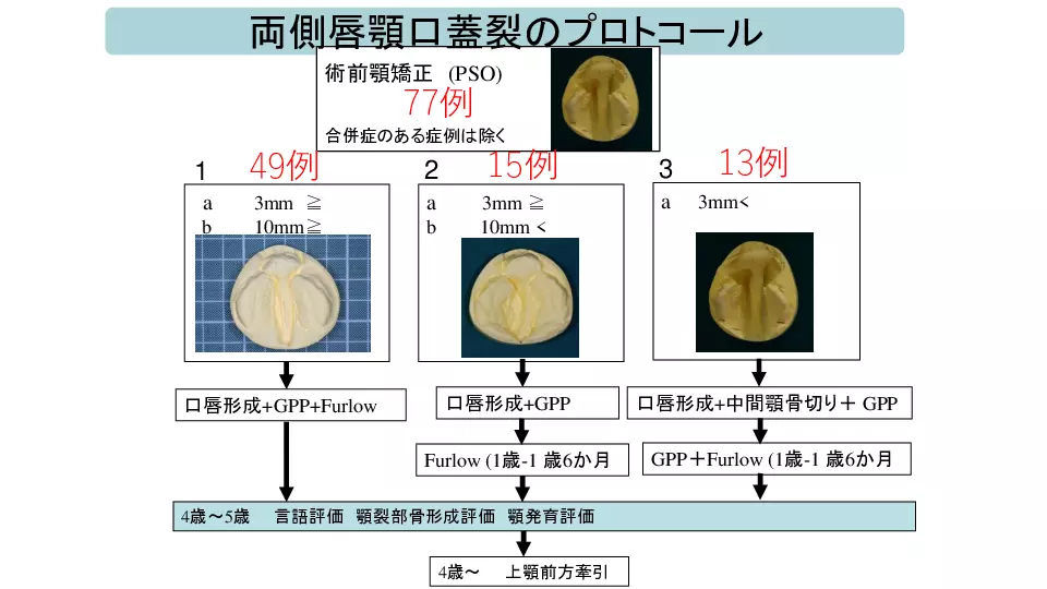 産科医・小児科医に知ってほしい！ 胎児診断から始まる口唇口蓋裂の